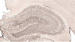 Žurkas hipokampa rajons (viens no galveniem rajoniem, kas piedalās atmiņas procesu realizācijā), kurā iekrāsots proteīns sinaptofizīns (atbild par sinaptisko plasticitāti un atmiņas procesiem). Bilde: V. Piļipenko.